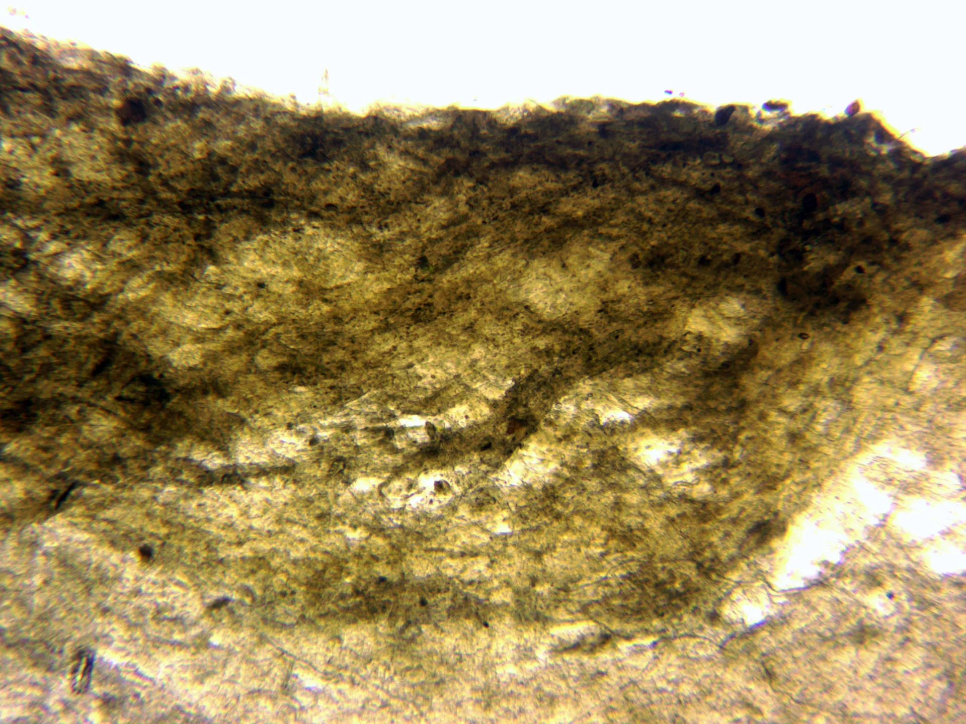 17 - Sección pileipellis agua x 100